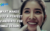 Smile Design Dental Treatment